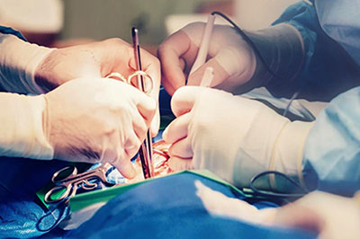 Minimal Invasive Heart Surgery